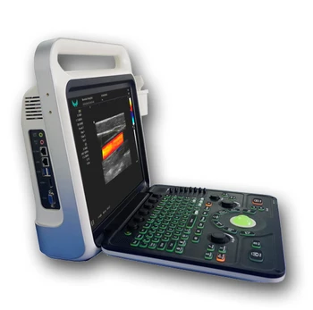 Многоцелевой цветной доплеровский диагностический аппарат YYHC E80, портативное ультразвуковое портативное устройство